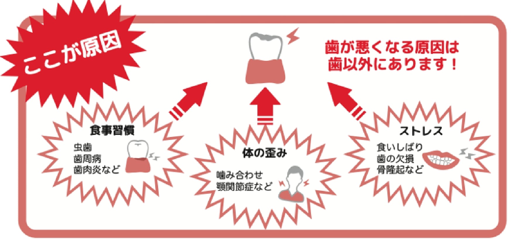 歯が悪くなる原因は歯以外にあります！