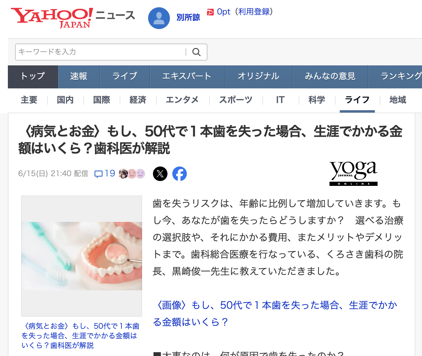 〈病気とお金〉もし、50代で１本歯を失った場合、生涯でかかる金額はいくら？歯科医が解説