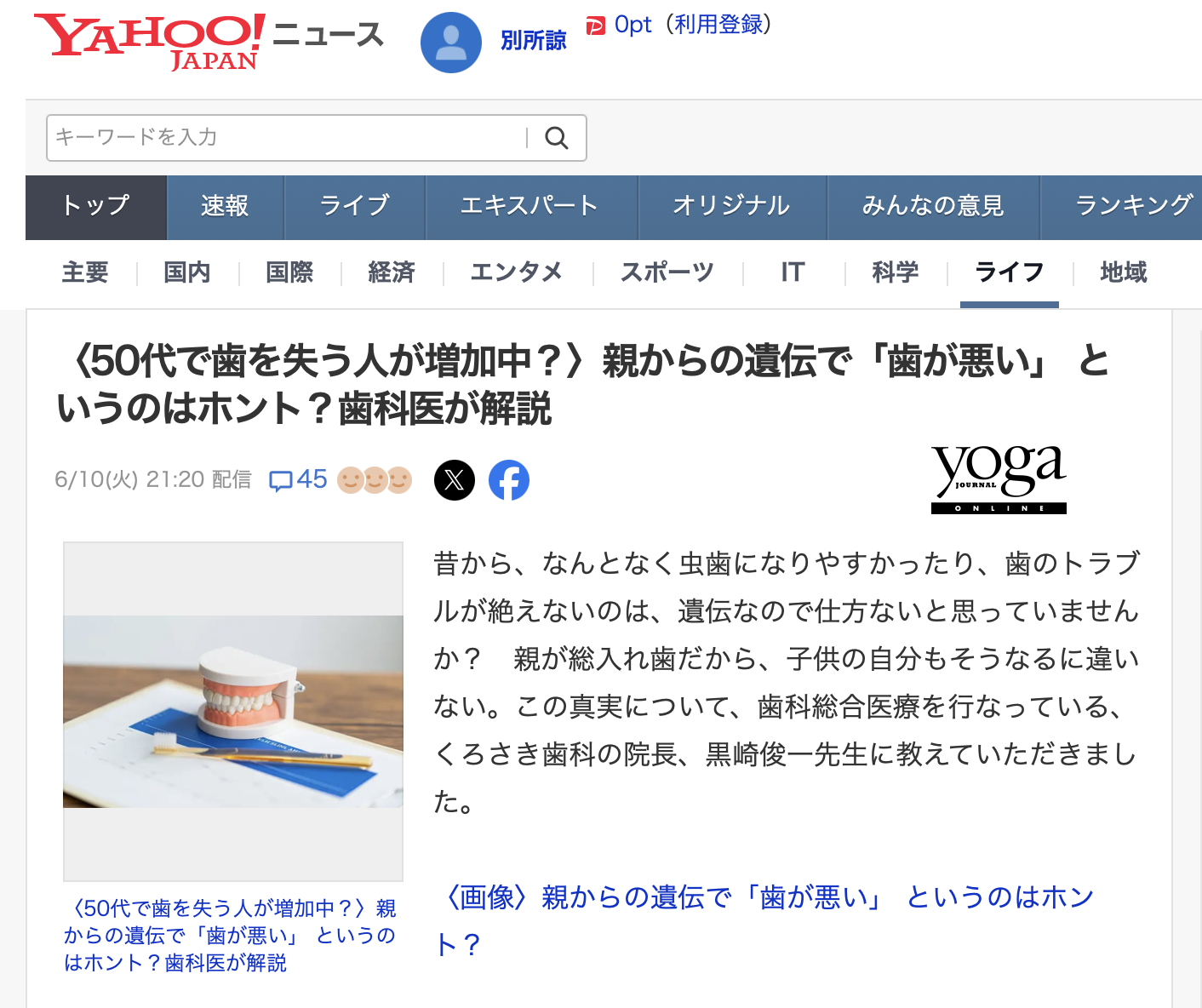 〈50代で歯を失う人が増加中？〉親からの遺伝で「歯が悪い」 というのはホント？歯科医が解説