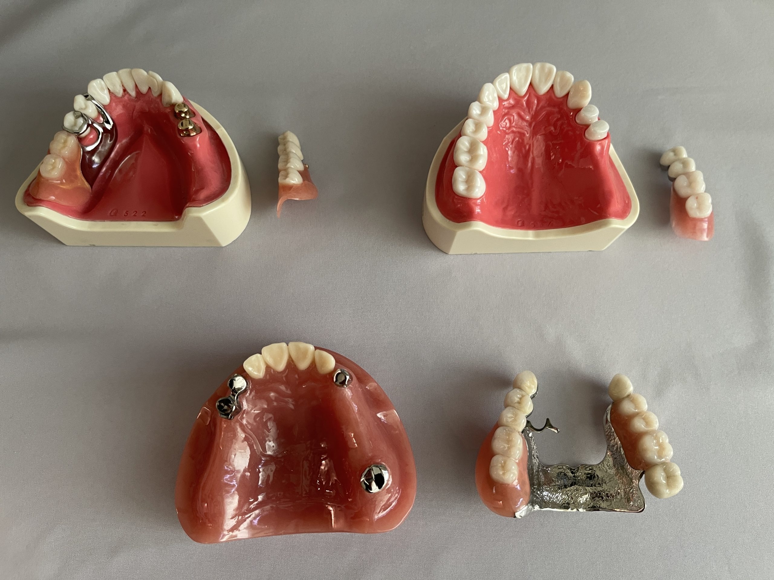【さいたま市】入れ歯・インプラントのおすすめ歯科医院４院を比較〜補綴専門医が“噛める治療”の選び方を徹底解説〜