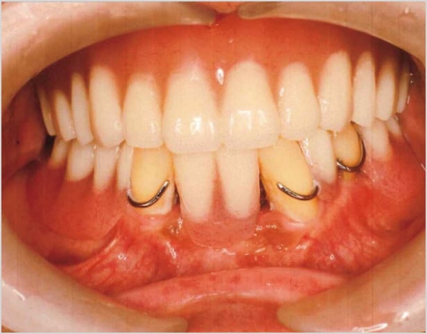 【症例2】50代男性治療後