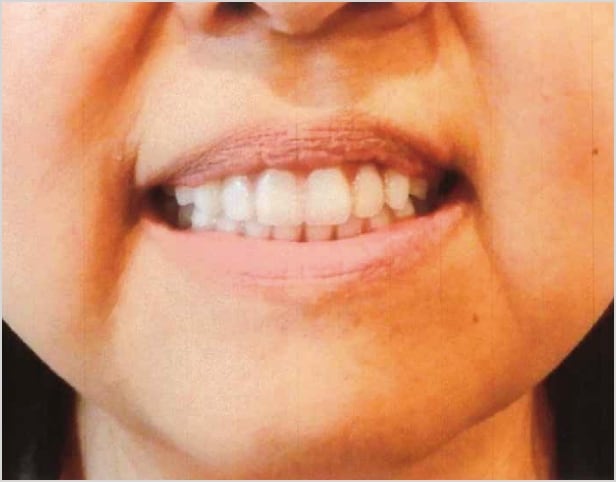 【症例4】50代女性治療後2