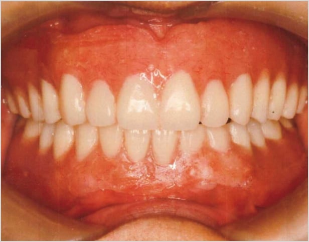 【症例4】50代女性治療後