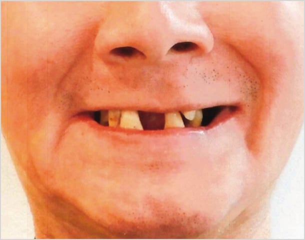 【症例2】50代男性治療前2