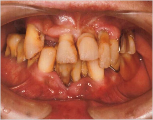 【症例2】50代男性治療前