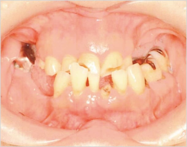 【症例4】50代女性治療前