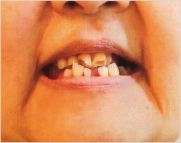 【症例4】50代女性治療前2