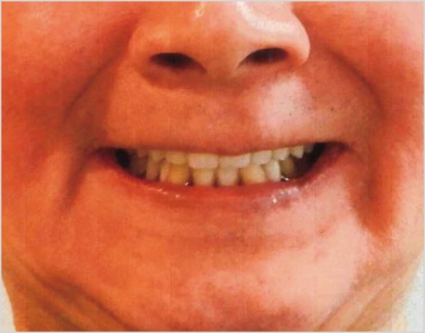 【症例2】50代男性治療後2