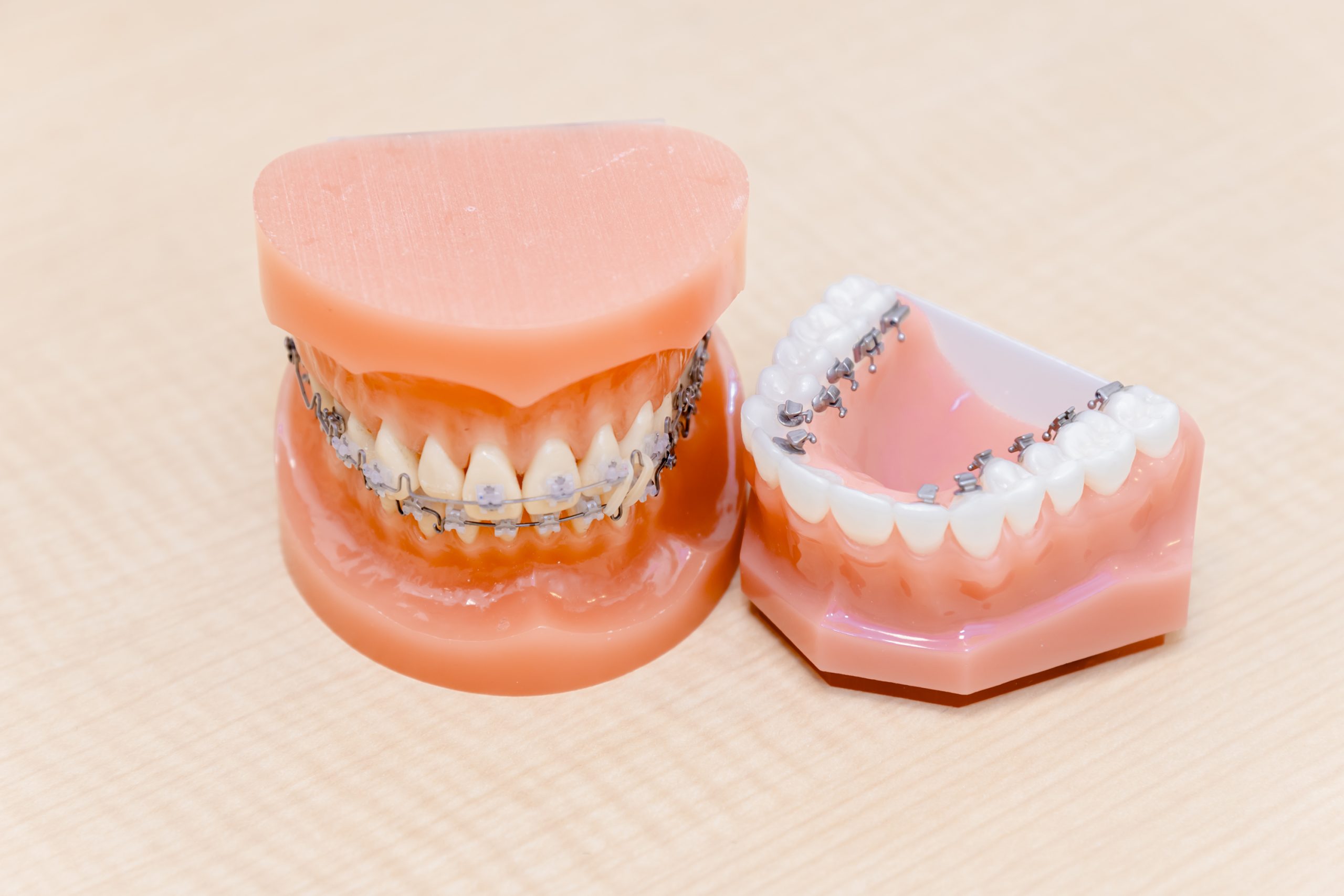 「矯正専門クリニックに行く前に知ってほしい、さいたま市・くろさき歯科が『かみ合わせ』にこだわる理由」/さいたま市歯科医師監修