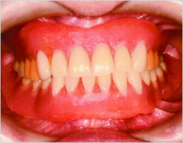 【症例8】60代女性治療前