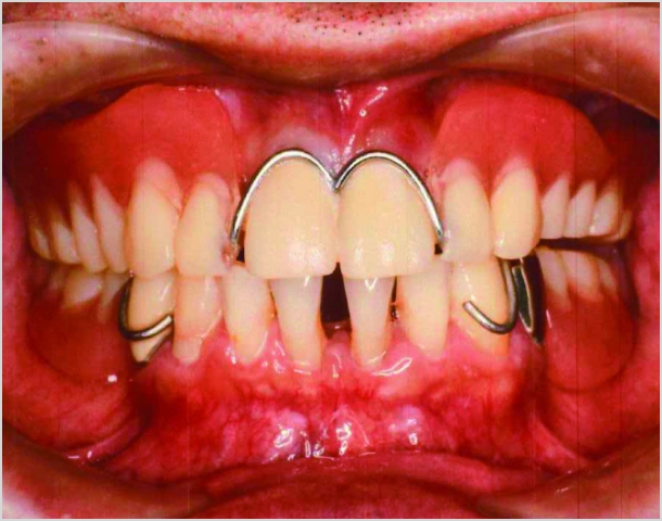 【症例7】50代男性治療前