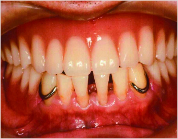 【症例7】50代男性治療後