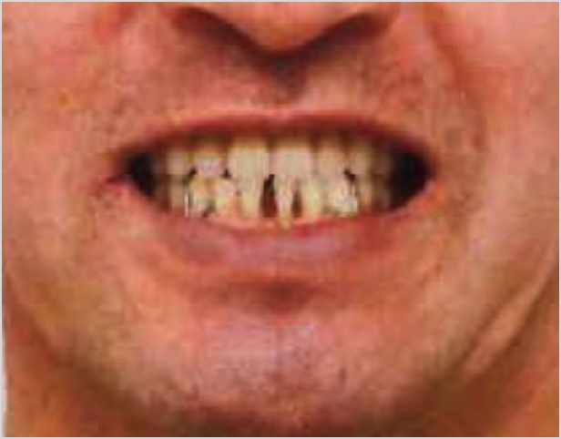 【症例7】50代男性治療後2