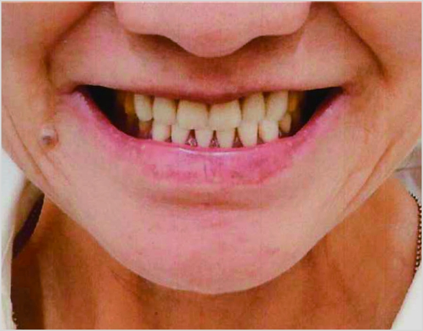 【症例8】60代女性治療前2