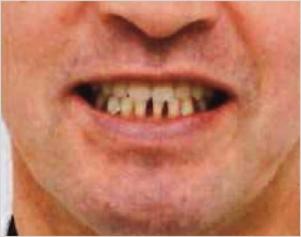 【症例7】50代男性治療前2