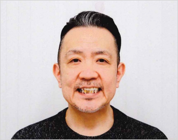 【症例13】50代男性治療前2