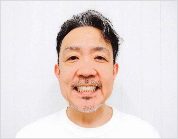 【症例13】50代男性治療後2